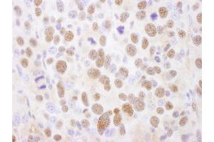 anti-Proteasome Subunit alpha 2 (PSMA2) (AA 184-234) antibody