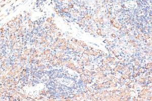 Immunohistochemistry of paraffin-embedded rat spleen using CD274 Antibody (ABIN6291806) at dilution of 1:100 (40x lens). (PD-L1 anticorps)