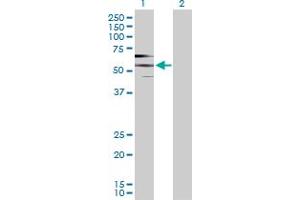 Western Blot analysis of PDE9A expression in transfected 293T cell line by PDE9A MaxPab polyclonal antibody. (PDE9A anticorps  (AA 1-533))