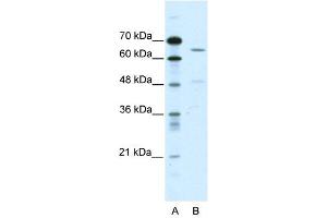ACCN1 antibody used at 2 ug/ml to detect target protein. (ACCN1 anticorps)