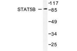 Western blot analysis of Stat5b antibody in extracts from HeLa cells. (STAT5B anticorps)