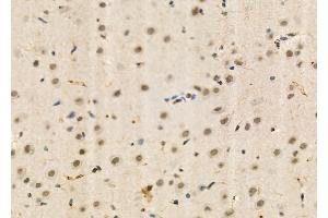 ABIN6260309 and ABIN6273995 at 1/100 staining Rat brain tissue by IHC-P.