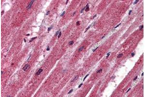 Human Heart: Formalin-Fixed, Paraffin-Embedded (FFPE)