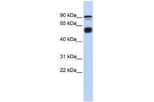 WB Suggested Anti-BCL11A Antibody Titration:  0. (BCL11A anticorps  (N-Term))
