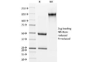 SDS-PAGE Analysis Purified Involucrin Mouse Monoclonal Antibody (SY5). (Involucrin anticorps)