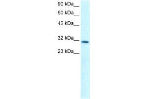 WB Suggested Anti-KLF8 Antibody Titration: 0. (KLF8 anticorps  (N-Term))