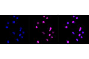 Immunocytochemical staining of HepG2 cells with MTA2 antibody (ABIN7799378), 1:1,000). (Recombinant MTA2 anticorps)