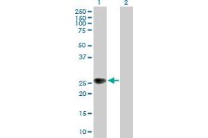 Western Blot analysis of ZNRF1 expression in transfected 293T cell line by ZNRF1 MaxPab polyclonal antibody. (ZNRF1 anticorps  (AA 1-227))
