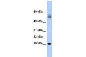 Image no. 1 for anti-Myotrophin (MTPN) (AA 35-84) antibody (ABIN6743678) (MTPN anticorps  (AA 35-84))