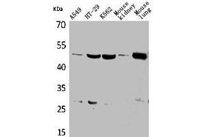 Western Blot analysis of A549 HT29 K562 mouse kidney mouse lung cells using GDI-2 Polyclonal Antibody (GDI2 anticorps  (C-Term))