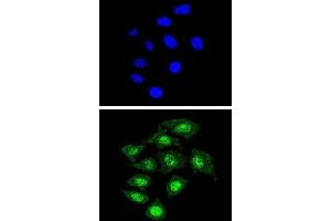 Immunofluorescence (IF) image for anti-Core-Binding Factor, beta Subunit (CBFB) antibody (ABIN3002868) (CBFB anticorps)