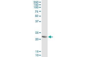 Immunoprecipitation of RCVRN transfected lysate using anti-RCVRN monoclonal antibody and Protein A Magnetic Bead , and immunoblotted with RCVRN MaxPab rabbit polyclonal antibody.