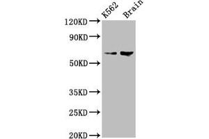 Western Blot Positive WB detected in: K562 whole cell lysate, Rat brain tissue All lanes: BRAP antibody at 7. (BRAP anticorps  (AA 13-124))