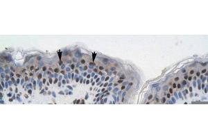Rabbit Anti-GTF21 Antibody ,Paraffin Embedded Tissue: Human Skin  Cellular Data: Squamous epithelial cells  Antibody Concentration: 4. (GTF2I anticorps  (N-Term))