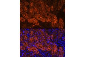 Immunofluorescence analysis of Mouse kidney using MIOX Rabbit pAb (ABIN7268729) at dilution of 1:100. (MIOX anticorps  (AA 1-285))