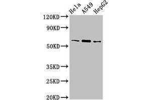 Western Blot Positive WB detected in: Hela whole cell lysate, A549 whole cell lysate, HepG2 whole cell lysate All lanes: TBL1X antibody at 3 μg/mL Secondary Goat polyclonal to rabbit IgG at 1/50000 dilution Predicted band size: 63, 58 kDa Observed band size: 63 kDa (TBL1X anticorps  (AA 1-300))