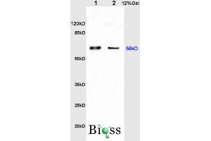 anti-Catalase (CAT) (AA 251-350) antibody