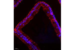 Immunofluorescence of paraffin embedded rat prostate using MYL6 (ABIN7074734) at dilution of 1:650 (400x lens)