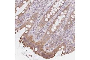 Immunohistochemical staining of human rectum with FAM208B polyclonal antibody  shows moderate cytoplasmic positivity in glandular cells at 1:50-1:200 dilution.