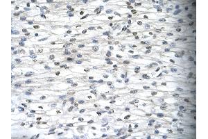 Rabbit Anti-SIRT5 Antibody       Paraffin Embedded Tissue:  Human cardiac cell   Cellular Data:  Epithelial cells of renal tubule  Antibody Concentration:   4.