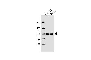 All lanes : Anti-FIBP1 Antibody (Center) at 1:2000 dilution Lane 1: HepG2 whole cell lysate Lane 2: Jurkat whole cell lysate Lysates/proteins at 20 μg per lane. (PPFIBP1 anticorps  (AA 588-617))