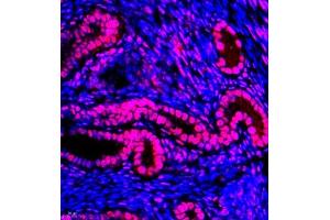 Immunofluorescence of paraffin embedded mouse uterus using TFIIIC110 (ABIN7074038) at dilution of 1:650 (400x lens)