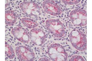 Rat Colon: Formalin-Fixed, Paraffin-Embedded (FFPE)