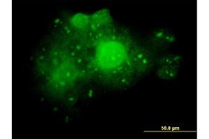 Immunofluorescence of monoclonal antibody to ALDOA on A-431 cell. (ALDOA anticorps  (AA 1-364))