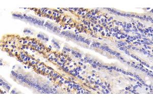 Detection of PIIINP in Mouse Small Intestine Tissue using Polyclonal Antibody to Procollagen III N-Terminal Propeptide (PIIINP) (PIIINP anticorps  (AA 24-154))