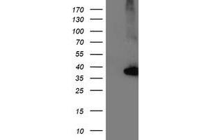 Western Blotting (WB) image for anti-Nudix (Nucleoside Diphosphate Linked Moiety X)-Type Motif 18 (NUDT18) antibody (ABIN1499862) (NUDT18 anticorps)