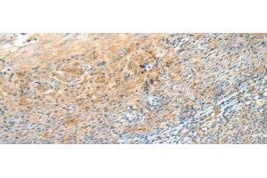 Immunohistochemistry of paraffin-embedded Human tonsil tissue using CLEC3B Polyclonal Antibody at dilution of 1:90(x200) (CLEC3B anticorps)