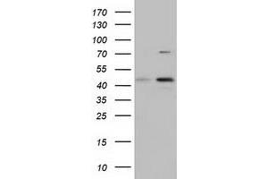 Western Blotting (WB) image for anti-COBW Domain Containing 1 (CBWD1) antibody (ABIN1497118)