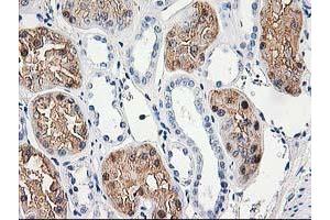 Immunohistochemical staining of paraffin-embedded Human Kidney tissue using anti-ACY1 mouse monoclonal antibody. (Aminoacylase 1 anticorps)