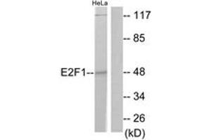 Western blot analysis of extracts from HeLa cells, treated with Etoposide 25uM 24h, using E2F1 (Ab-433) Antibody. (E2F1 anticorps  (AA 388-437))