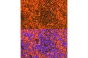 Immunofluorescence analysis of rat spleen using CD83 Rabbit mAb (ABIN7266223) at dilution of 1:100 (40x lens).