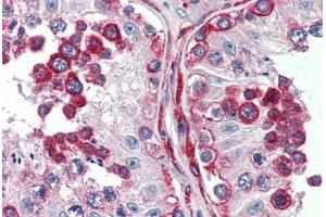 Human Testis (formalin-fixed, paraffin-embedded) stained with DLG4 antibody ABIN396947 at 5 ug/ml followed by biotinylated goat anti-rabbit IgG secondary antibody ABIN481713, alkaline phosphatase-streptavidin and chromogen.