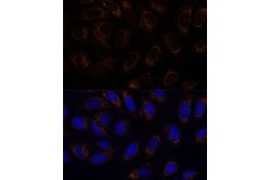 anti-Receptor (G Protein-Coupled) Activity Modifying Protein 1 (RAMP1) (AA 27-117) antibody