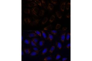 Immunofluorescence analysis of U-2 OS cells using R antibody (ABIN6132582, ABIN6146672, ABIN6146673 and ABIN6222096) at dilution of 1:100. (RAMP1 anticorps  (AA 27-117))