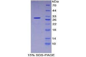 SDS-PAGE (SDS) image for Intercellular Adhesion Molecule 3 (ICAM3) (AA 259-491) protein (His tag) (ABIN1877721)