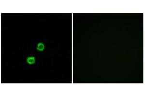 Immunofluorescence analysis of MCF-7 cells, using GCNT7 antibody. (GCNT7 anticorps  (C-Term))