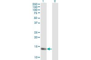 Western Blot analysis of MB expression in transfected 293T cell line by MB monoclonal antibody (M13), clone 4F8.