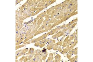 Immunohistochemistry of paraffin-embedded Rat heart using PEX5 antibody at dilution of 1:100 (x400 lens). (PEX5 anticorps)