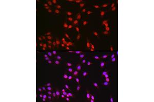 Immunofluorescence analysis of PC-12 cells using CREB1 Rabbit pAb (ABIN7266053) at dilution of 1:50 (40x lens).