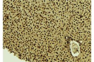 ABIN6277533 at 1/100 staining Mouse liver tissue by IHC-P.