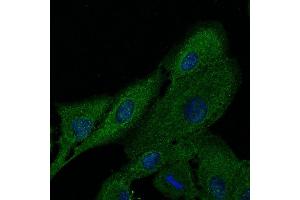 Immunofluorescence - anti-FTCD Ab at 1/100 dilution in NHl/3T3 cells were fixed with methanol and permeabilized With 0.