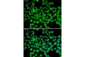 Immunofluorescence analysis of U2OS cells using ARRB2 antibody. (Arrestin 3 anticorps)