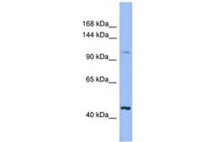 Image no. 1 for anti-Xylosyltransferase II (XYLT2) (AA 575-624) antibody (ABIN6741764) (XYLT2 anticorps  (AA 575-624))