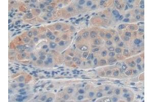 Detection of DDIT3 in Human Liver Tissue using Polyclonal Antibody to DNA Damage Inducible Transcript 3 (DDIT3)