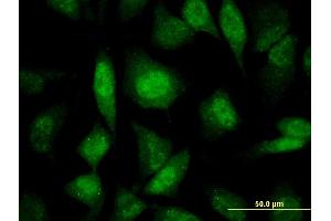 Immunofluorescence of monoclonal antibody to PRPF19 on HeLa cell.