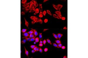 Immunofluorescence analysis of HeLa cells using TRPC6 antibody (ABIN7270918) at dilution of 1:100 (40x lens).